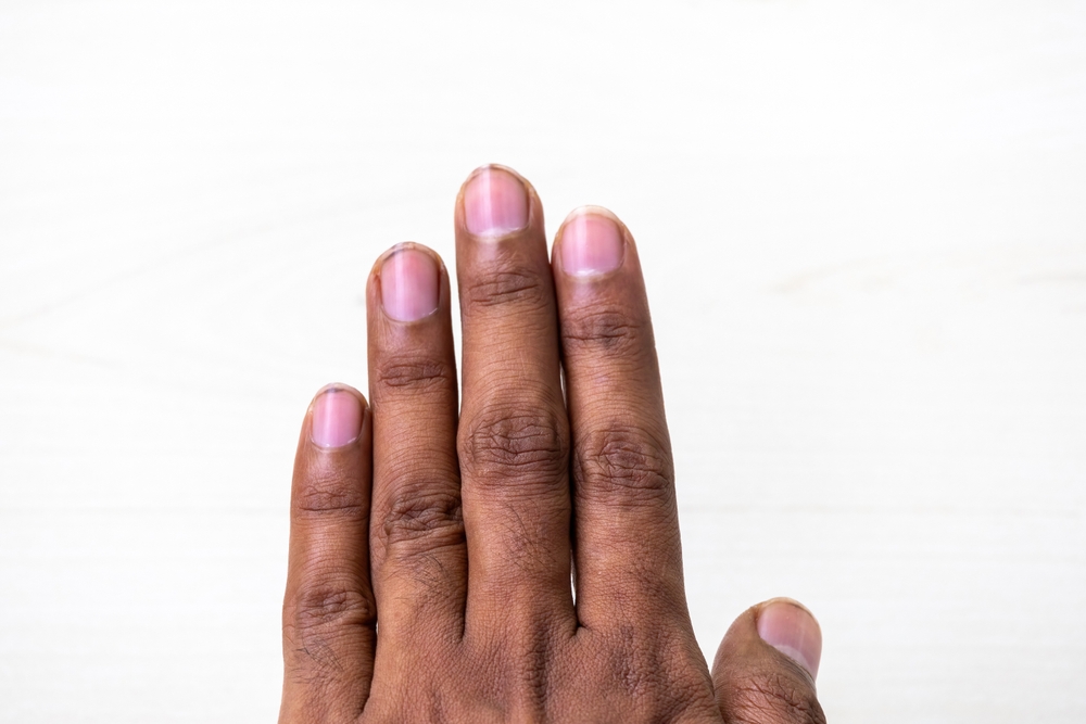 dirt, hands, fingernails, health