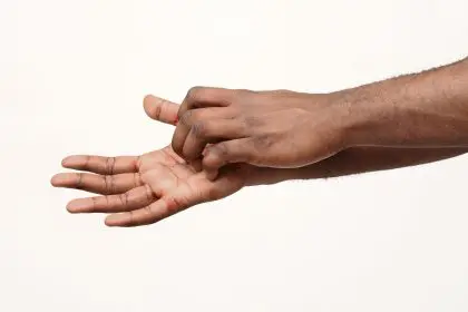 Your itchy palm