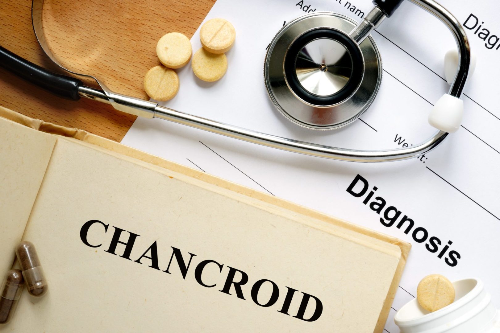 Chancroid STD signs