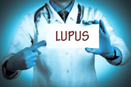 How lupus tricks