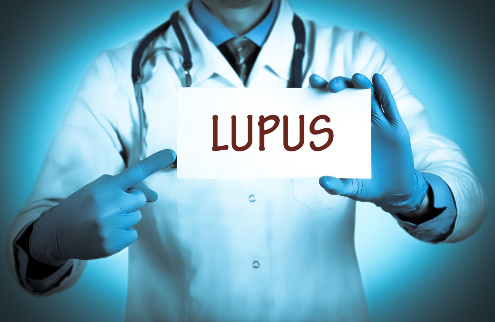 How lupus tricks