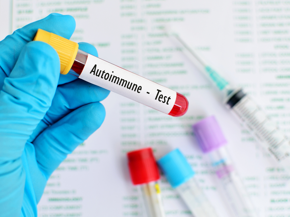autoimmune, body, disease