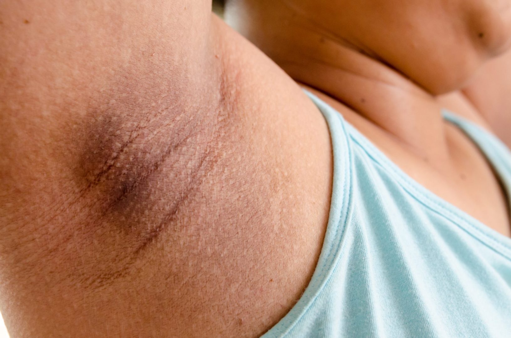 Fade underarm fast