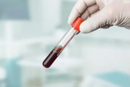 boost your hemoglobin levels