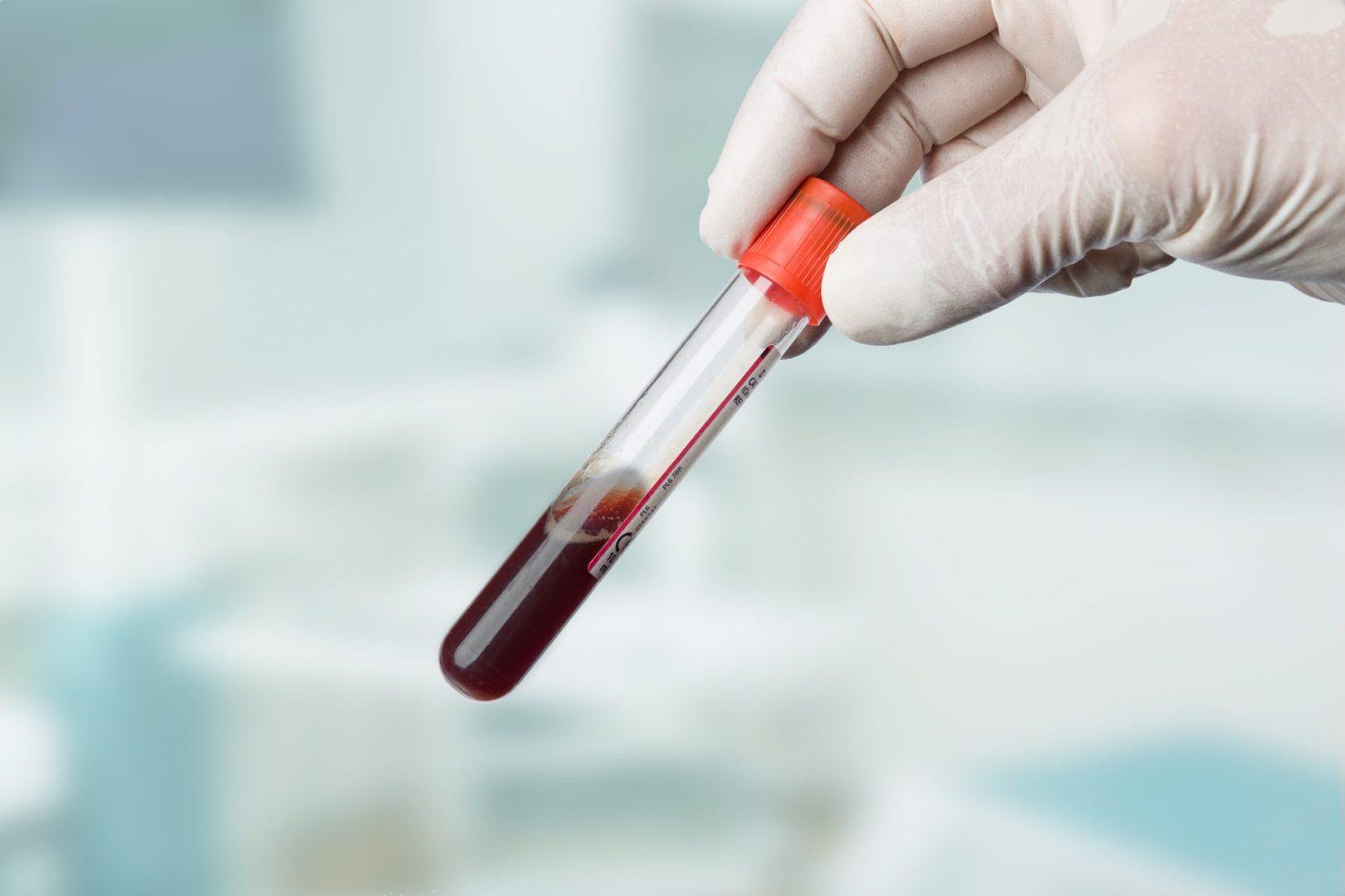 boost your hemoglobin levels