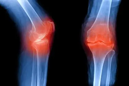 posterior knee pain