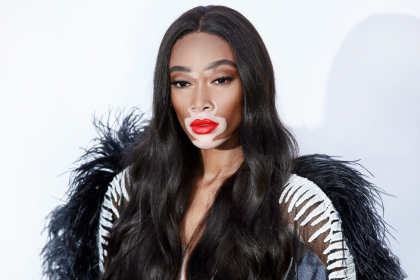 Winnie Harlow