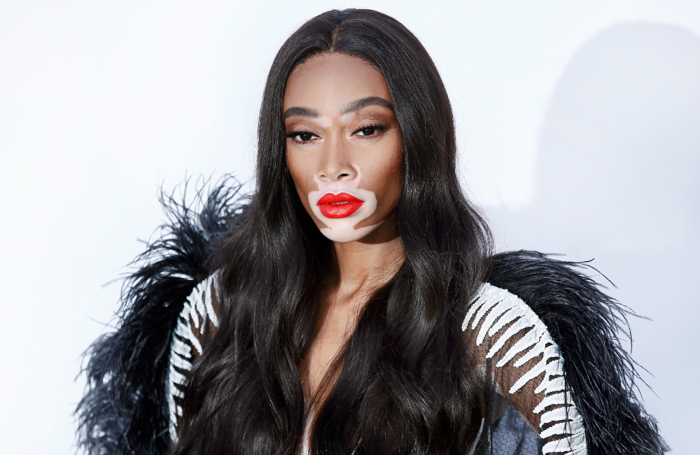 Winnie Harlow