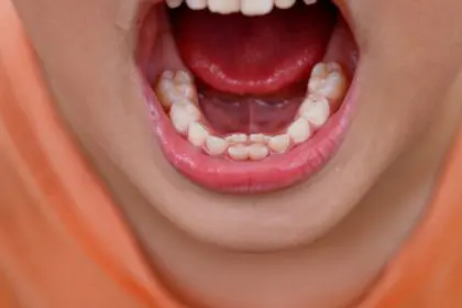 Shark teeth