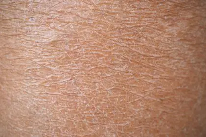 Bad skin habits