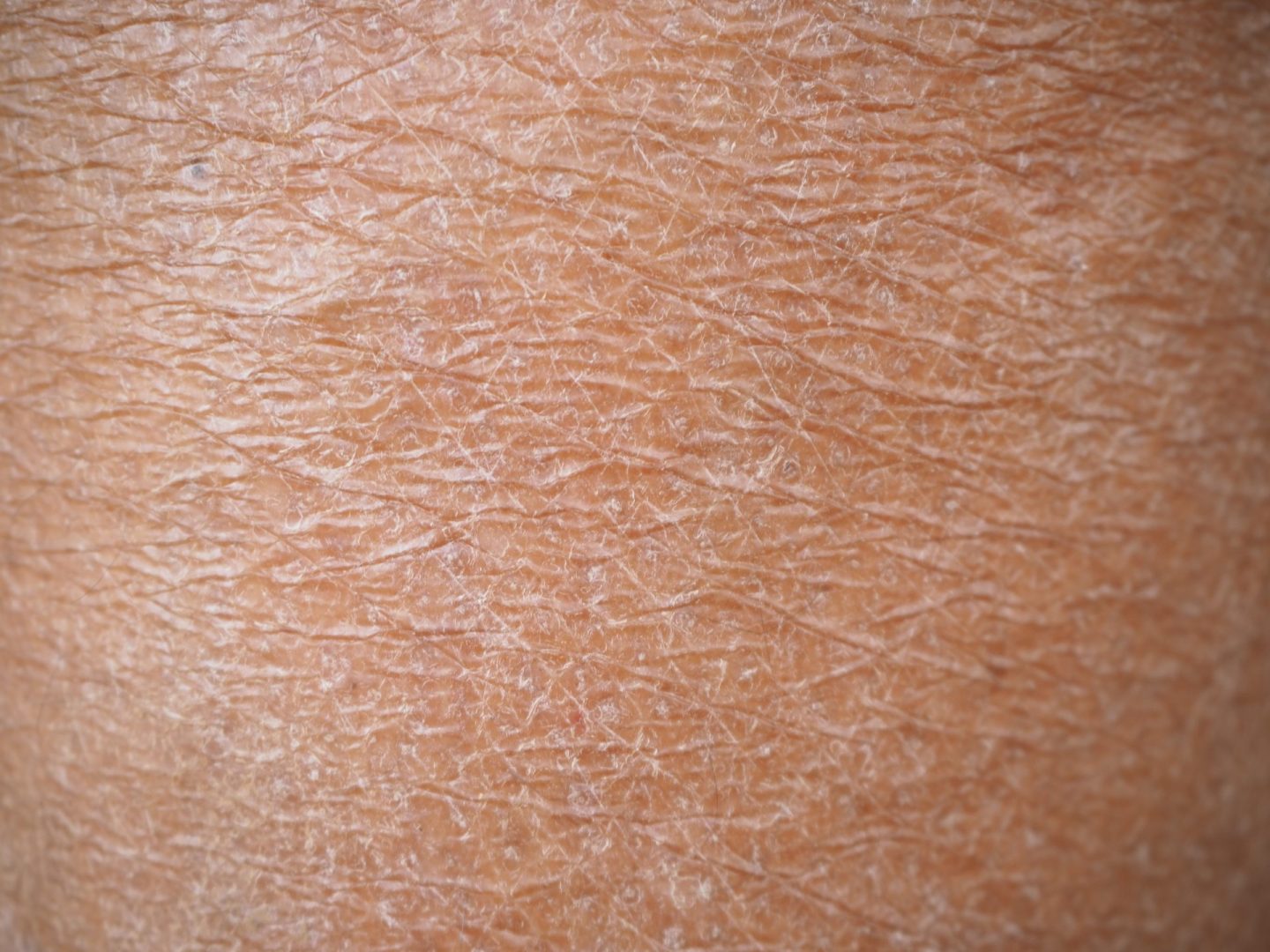 Bad skin habits