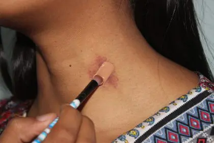 hickey, love bites, romance