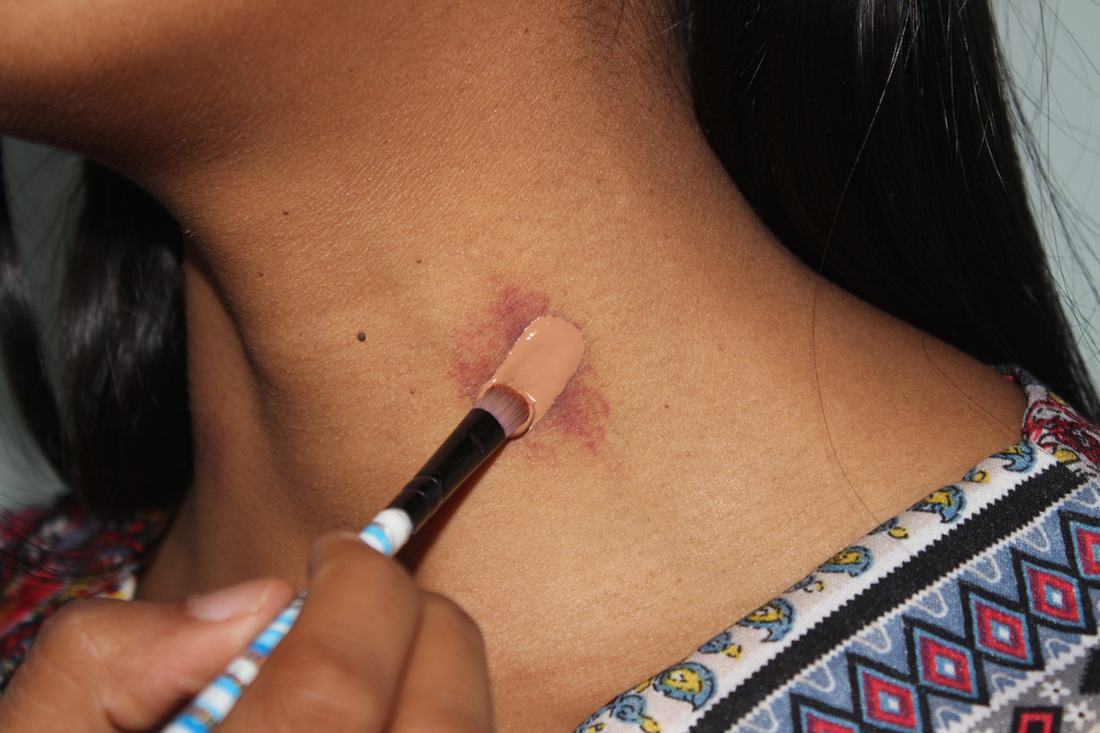 hickey, love bites, romance