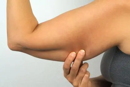 Sarcopenic Obesity Threat