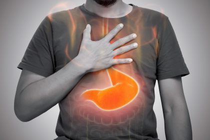Cure GERD without prescription