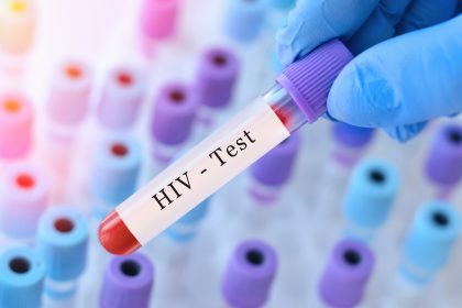 Your HIV testing