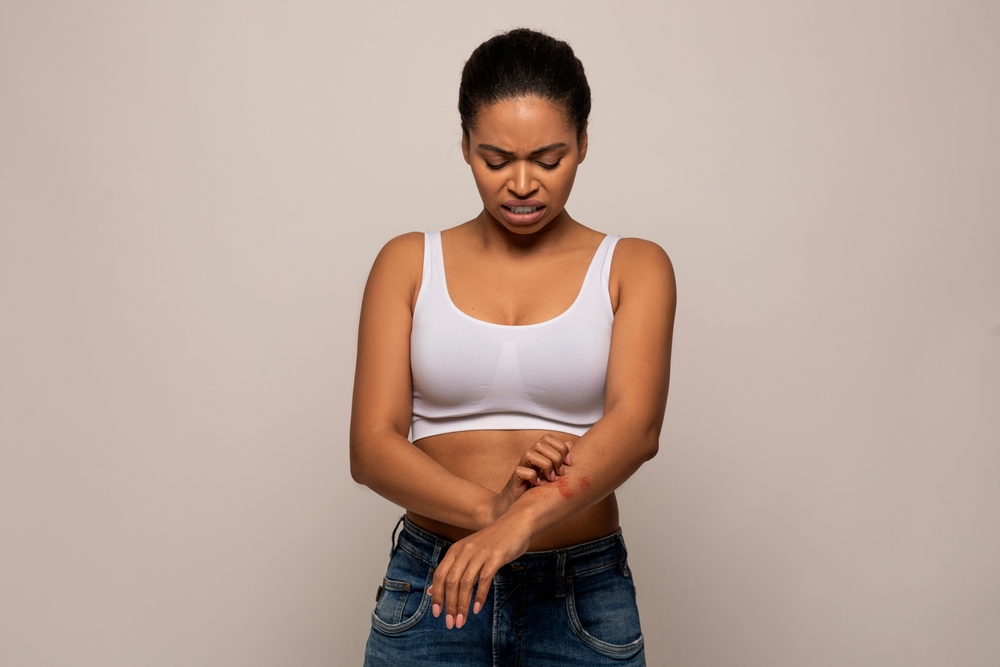 Skin, allergies, blisters