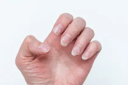 Nails, health, hidden