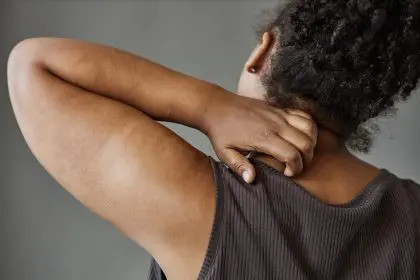 Weird eczema trick