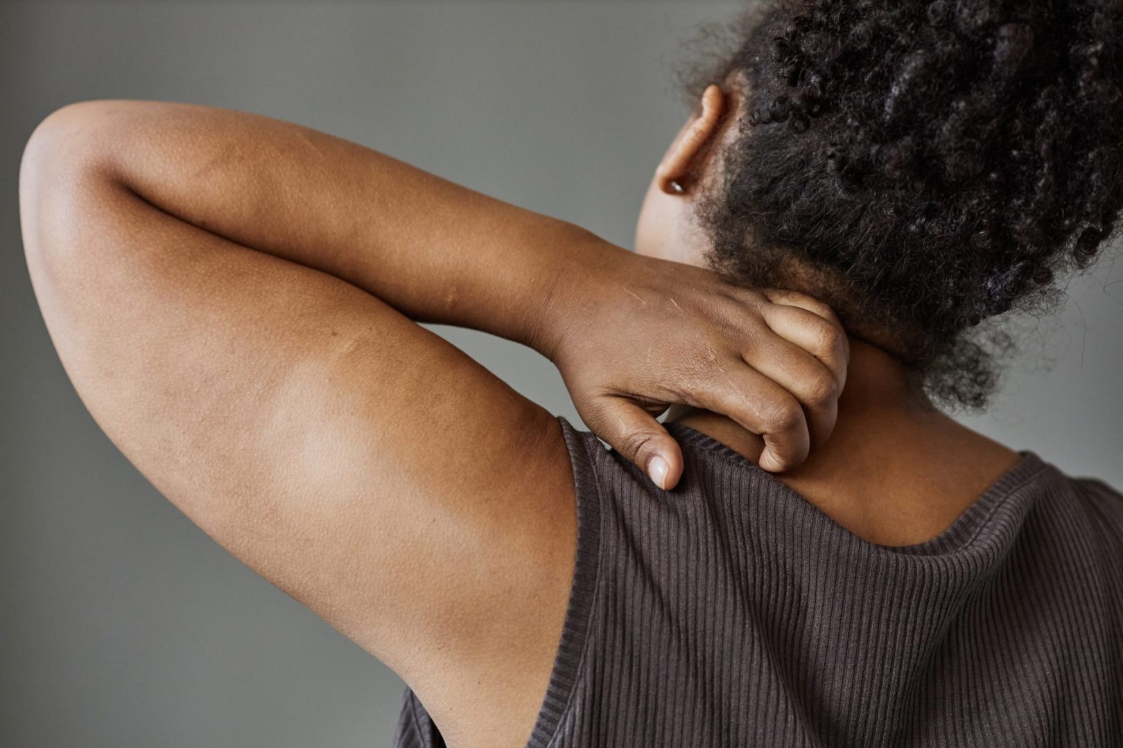 Weird eczema trick