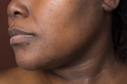 your skin looking lifeless