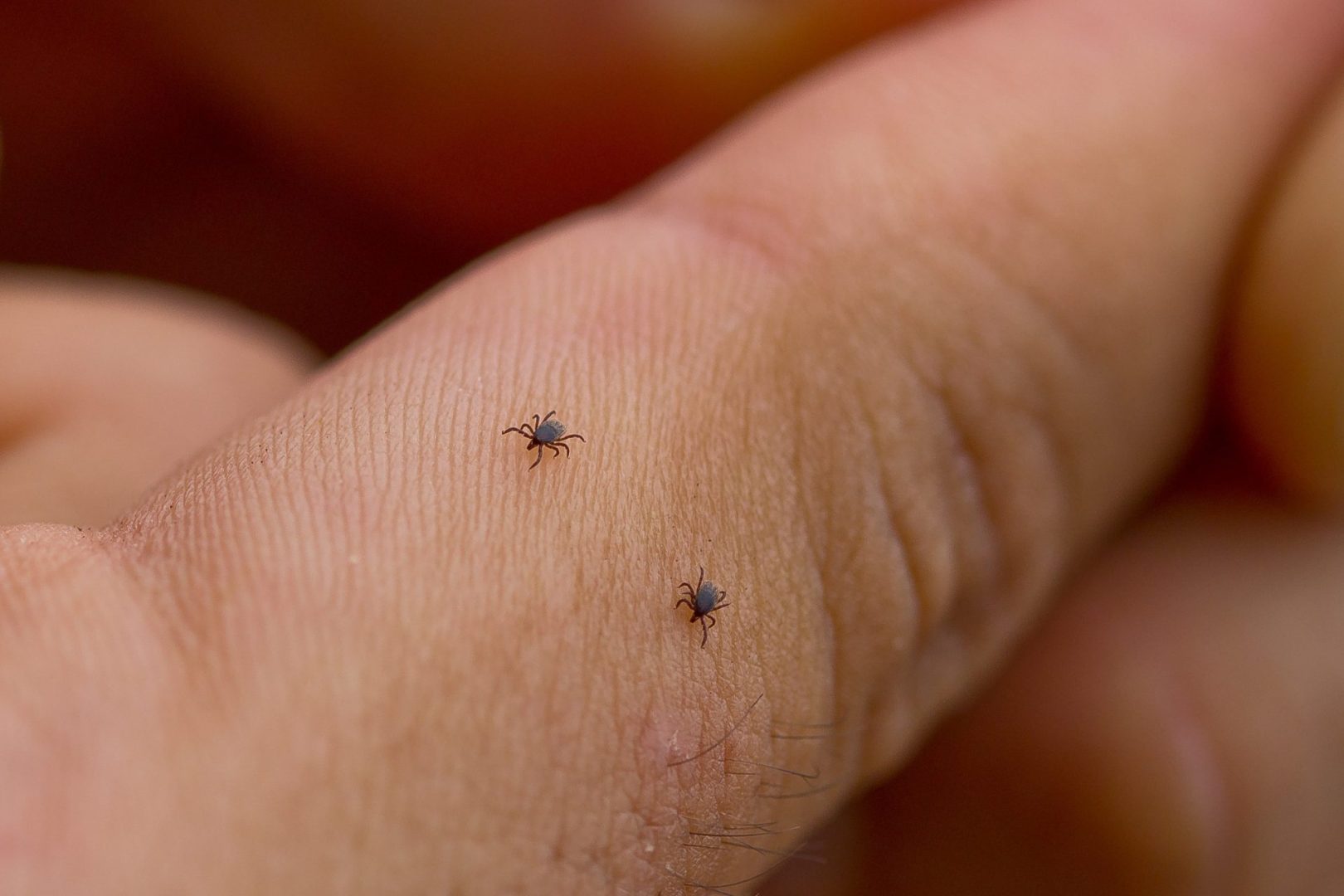 The tick-borne diseases
