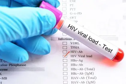 CD4, Viral load, hiv, test