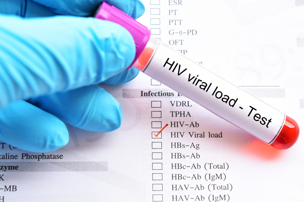 CD4, Viral load, hiv, test