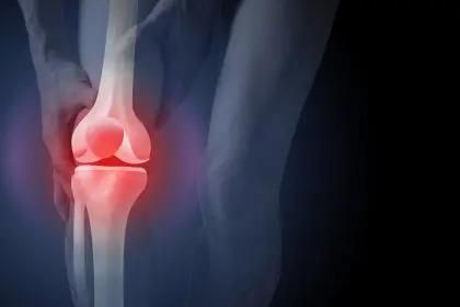Bone cancer