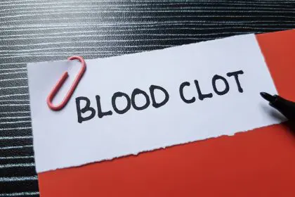 5 critical blood clot