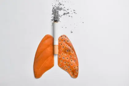 Lungs after years of smoking