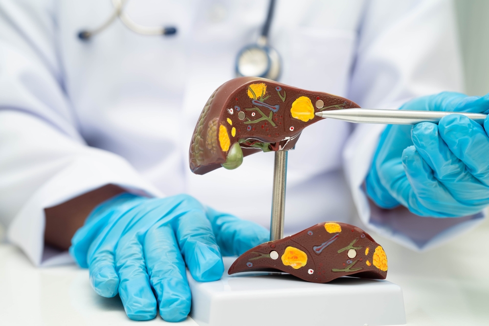How to naturally reduce fat from your liver fast
