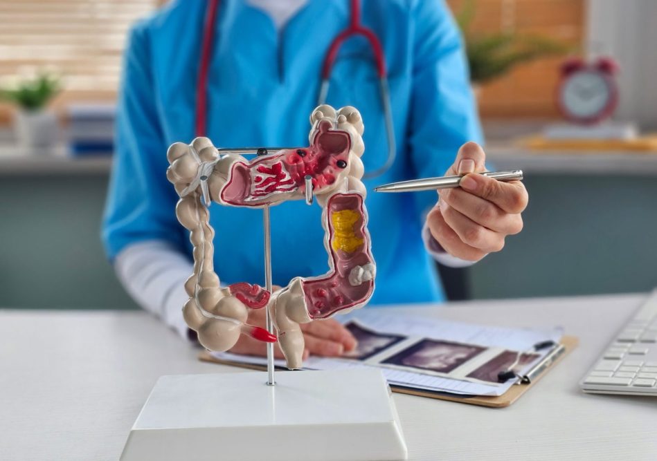 7 powerful ways to lower your colorectal cancer risk