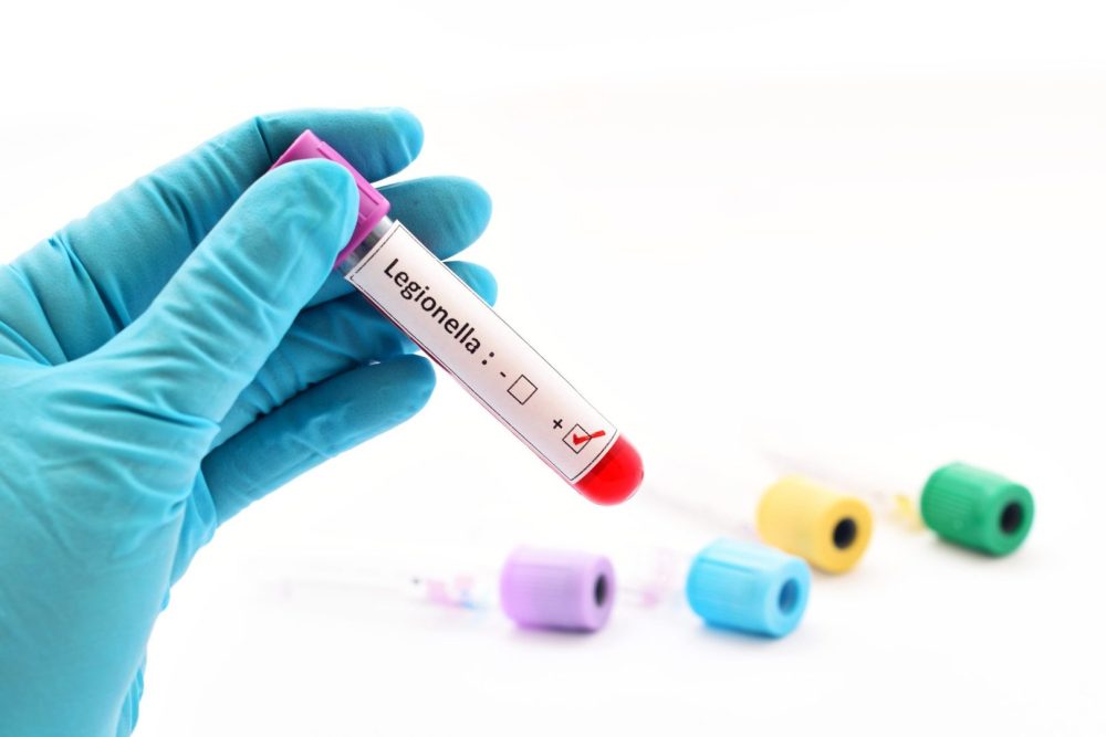 Legionnaires’ disease outbreak alarms NYC as cases hit 18